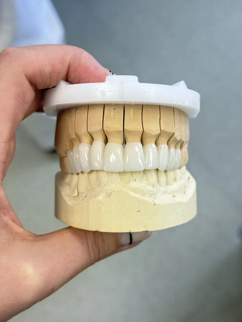 Anatomické korunky B1