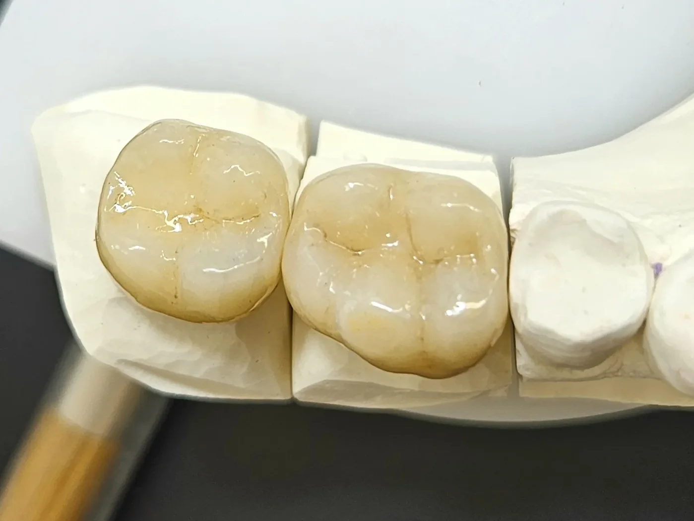 Zirconia firing — done