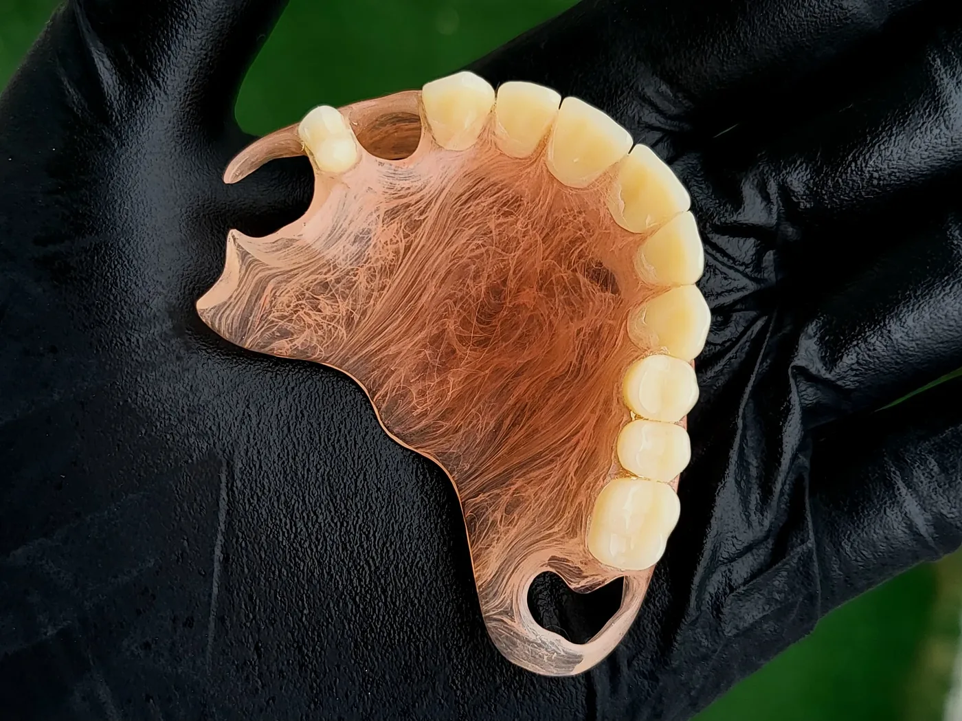 Deflex — upper partial