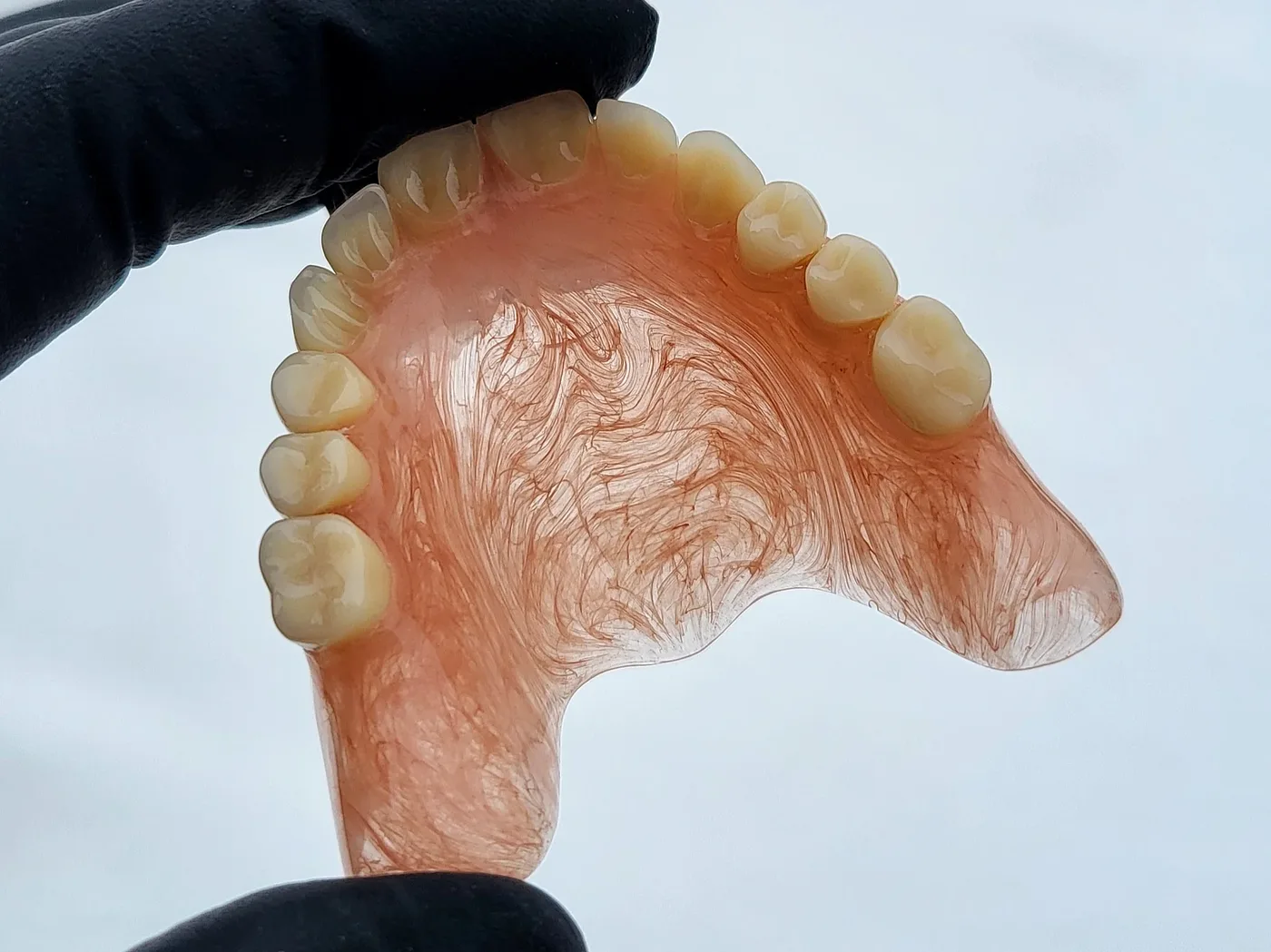Deflex — full denture