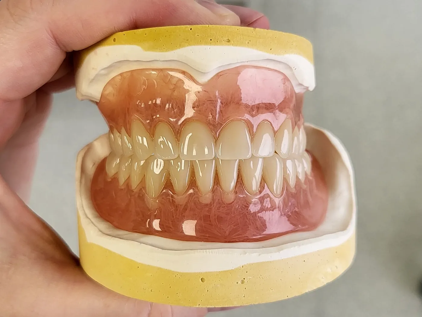 Deflex full dentures I.