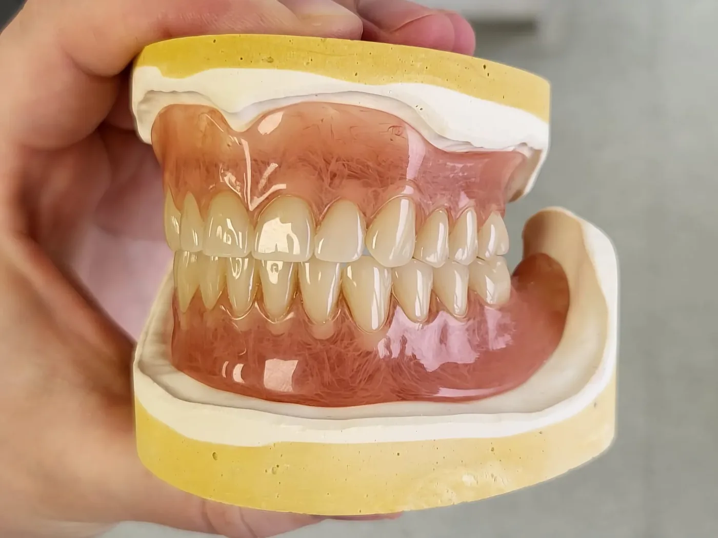 Deflex full dentures II.