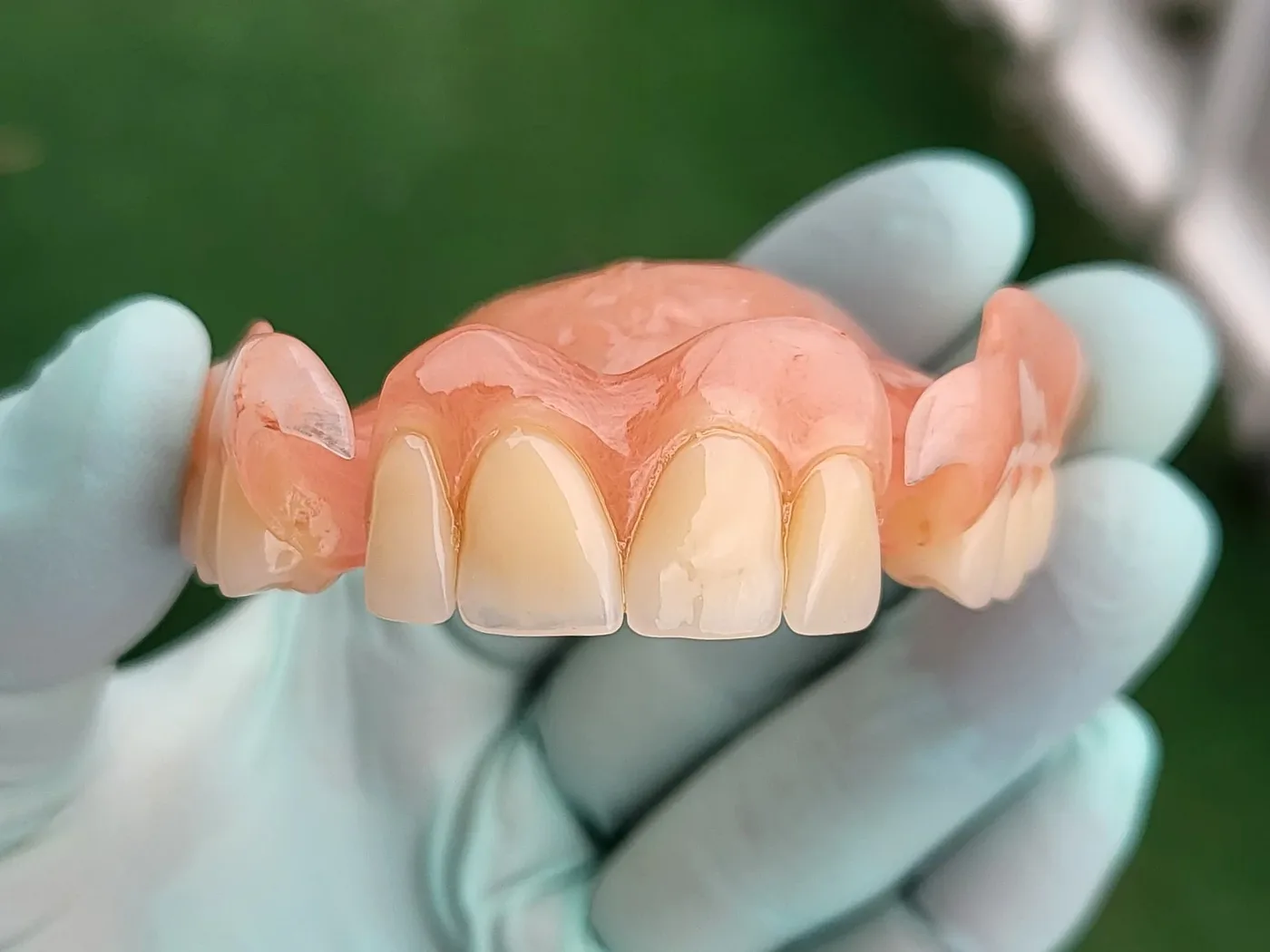 Upper partial Deflex