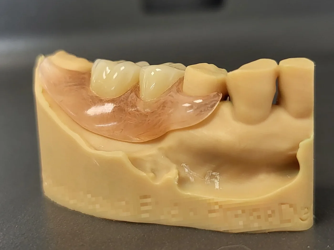 Small partial Deflex