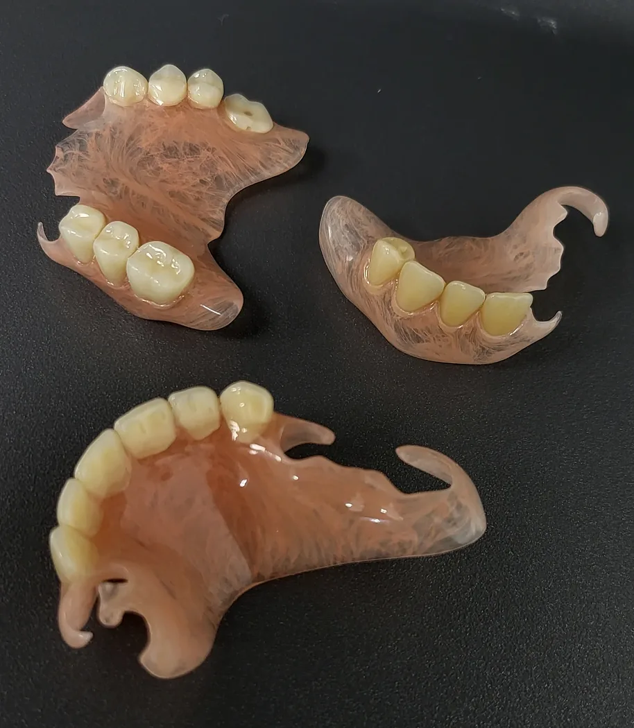 Deflex dentures — overview