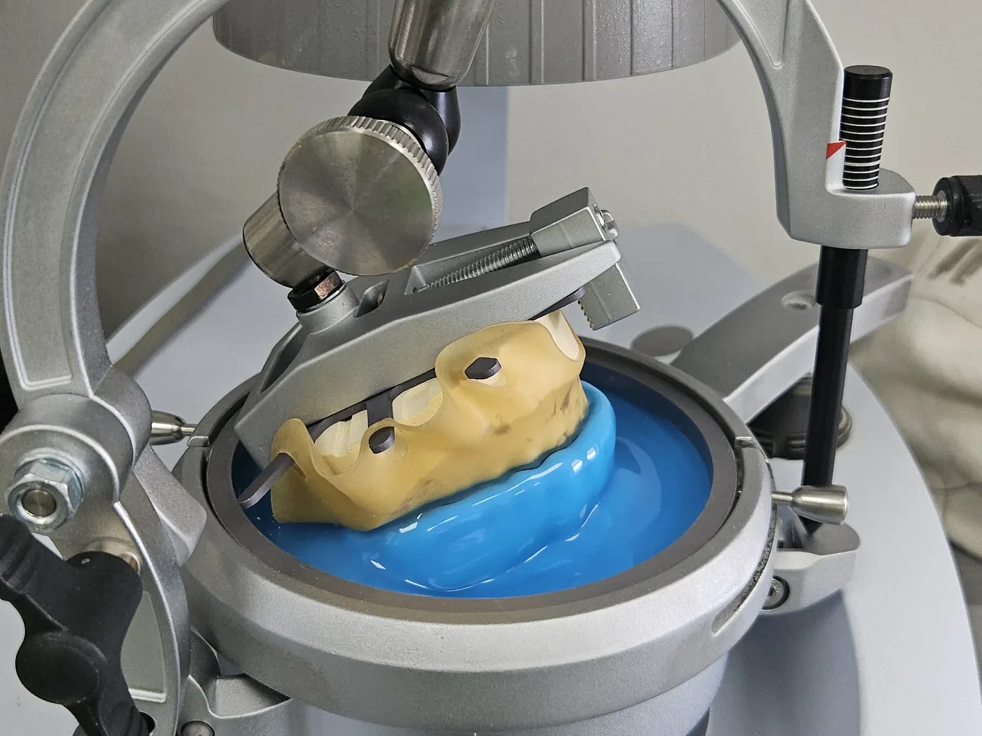 Sport mouthguard — occlusion
