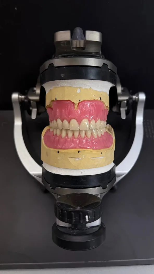 Modelling in articulator